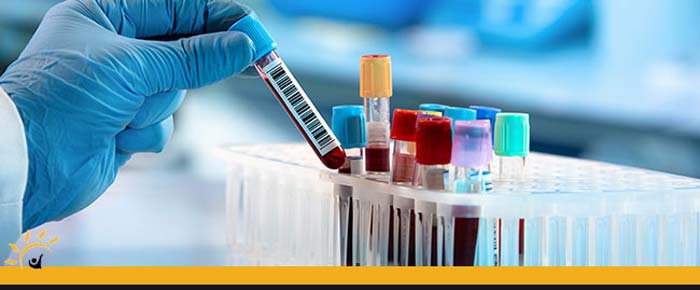 Walk-In Urgent Care Blood Testing Clinic Near Me in Ellington CT, Unionville CT, East Haven CT, Cromwell CT, Oxford, CT and Newington, CT Walk-In Urgent Care Blood Testing Clinic Near Me in Ellington CT, Unionville CT, East Haven CT, Cromwell CT, Oxford, CT and Newington, CT