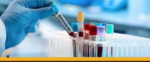Walk-In Urgent Care Blood Testing Clinic Near Me in Ellington CT, Unionville CT, East Haven CT, Cromwell CT, Oxford, CT and Newington, CT Walk-In Urgent Care Blood Testing Clinic Near Me in Ellington CT, Unionville CT, East Haven CT, Cromwell CT, Oxford, CT and Newington, CT