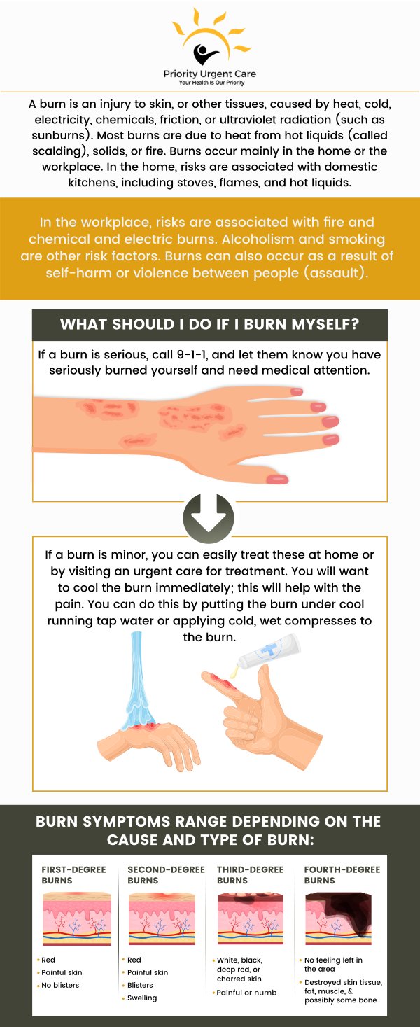 A burn of the first degree is a minor burn that exclusively affects the skin's surface. Minor burns cause redness, pain, and swelling. If you have a first-degree burn and are unsure of how to treat it, our experienced professionals will help you feel better. For more information, please contact us or book an appointment online. We have convenient locations to serve you in Ellington CT, Unionville CT, East Haven CT, Cromwell CT, Oxford, CT and Newington, CT.