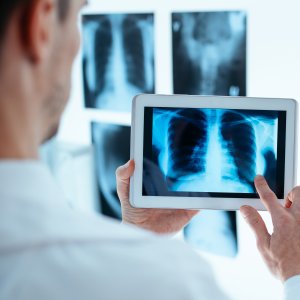 X-Ray Services Near Me in Chicopee, Springfield and Westfield, MA