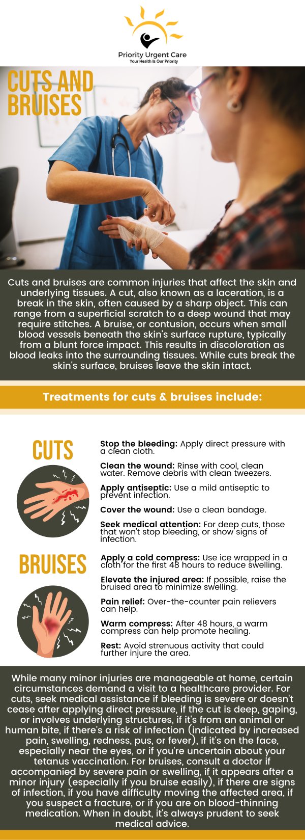 Get treatment for bruises today! Priority Urgent Care and Walk-In Clinic is home to a team of leading healthcare professionals. Bruises are a common result of minor injuries when small blood vessels under the skin break, causing discoloration and tenderness. While most heal on their own, some bruises can be painful, swollen, or linked to deeper injuries that may need medical attention. Our providers can evaluate your condition, rule out complications, and recommend proper care to support faster healing and peace of mind. Contact us today or visit us online to book an appointment. Walk-ins are welcome! We have convenient locations to serve you in Cromwell CT, East Haven CT, Ellington CT, Newington, CT, Oxford, CT and Unionville CT.