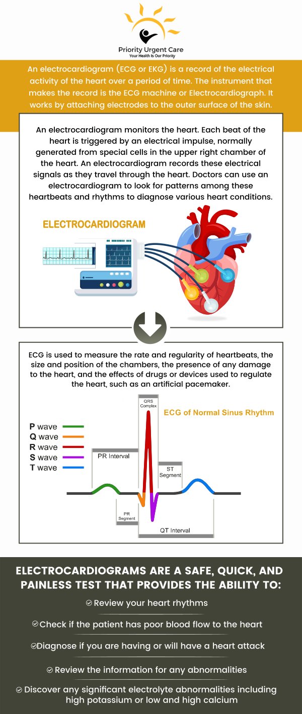 The cost of an EKG test can vary depending on your healthcare provider and insurance coverage. At Priority Urgent Care, we offer affordable EKG testing with transparent pricing to ensure you receive quality care. We also provide guidance on billing and insurance coverage to help you navigate the cost of the test. For more information, please contact us today. We have convenient locations to serve you in Cromwell CT, East Haven CT, Ellington CT, Newington, CT, Oxford, CT and Unionville CT.