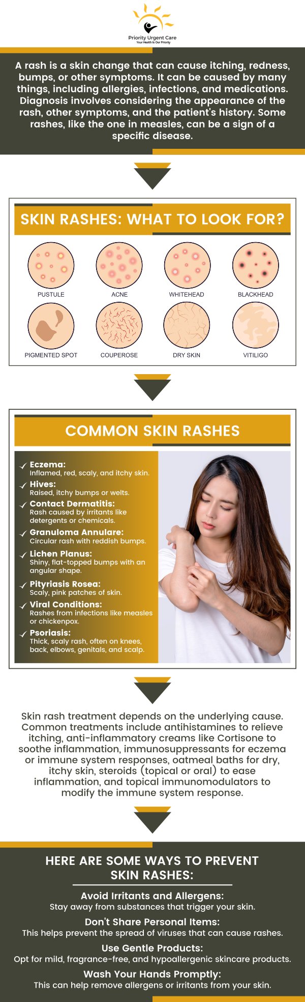 Skin rashes can occur from a variety of factors, including infections, heat, allergens, immune system disorders and medications. Do you have a skin rash and need help treating it? Visit Priority Urgent Care & Walk In Clinic, we specialize in providing the best care for your day-to-day problems. For more information, please contact us or schedule an appointment online. We have convenient locations to serve you in Ellington CT, Unionville CT, East Haven CT, Cromwell CT, Oxford, CT and Newington, CT.