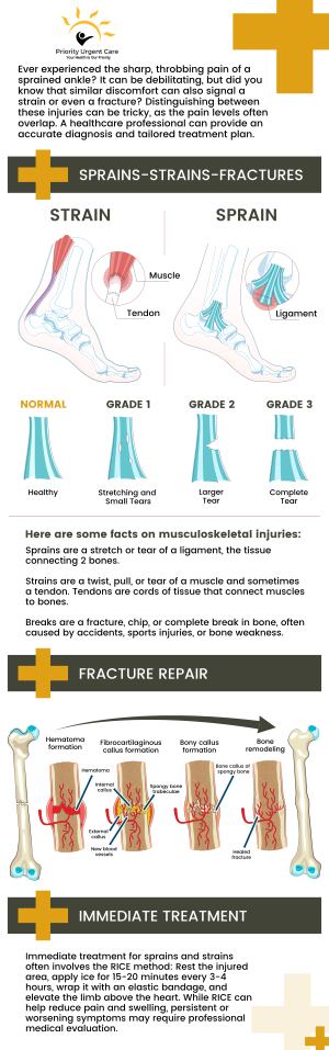 Don’t let sprains and strains affect your daily routine! If you or someone you know has sustained a strain or sprain, come to Priority Urgent Care today! Our kind and compassionate staff are highly experienced in treating all kinds of sprains and strains. For more information, please contact us today or simply walk-in. We have convenient locations to serve you in Ellington CT, Unionville CT, East Haven CT, Cromwell CT, Oxford CT and Newington CT.