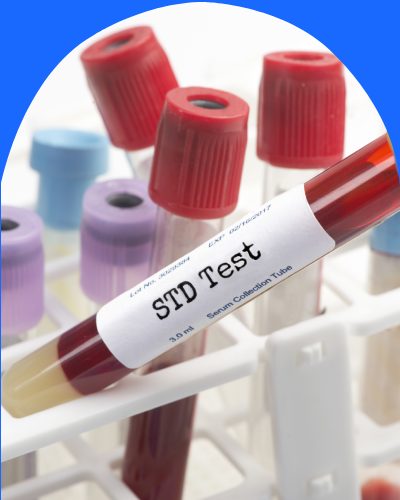 STD Testing Near Me in Cromwell CT, East Haven CT, Ellington CT, Newington, CT, Oxford, CT, Unionville CT, Wallingford, CT, Chicopee MA, Springfield MA and Westfield MA